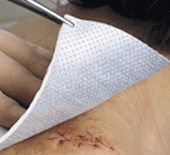 Metalline steriel nonwoven kompres 8 cm x 10 cm