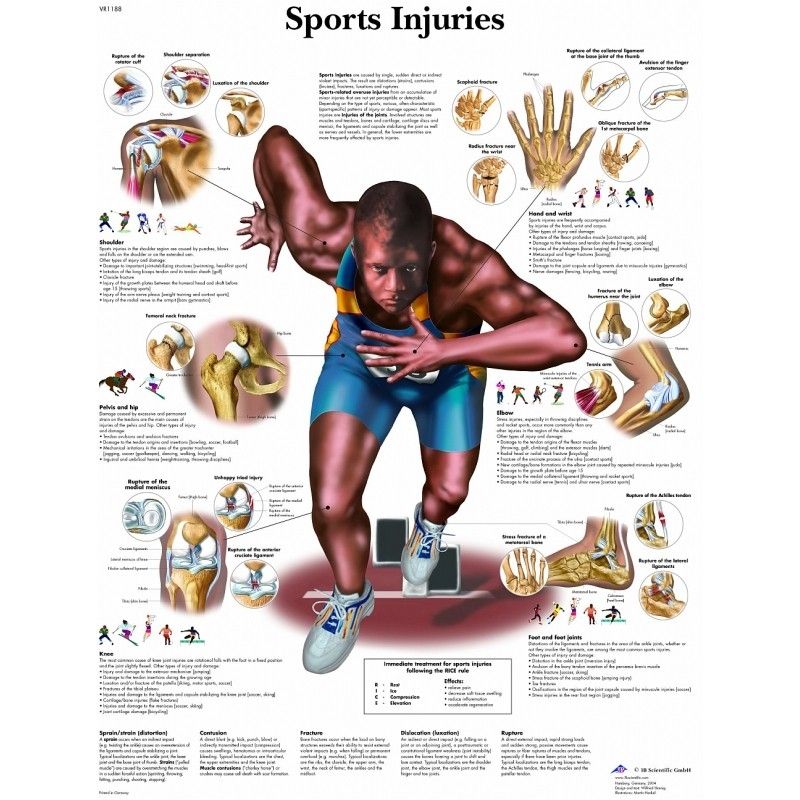 Anatomie poster Sports Injuries - sportblessures
